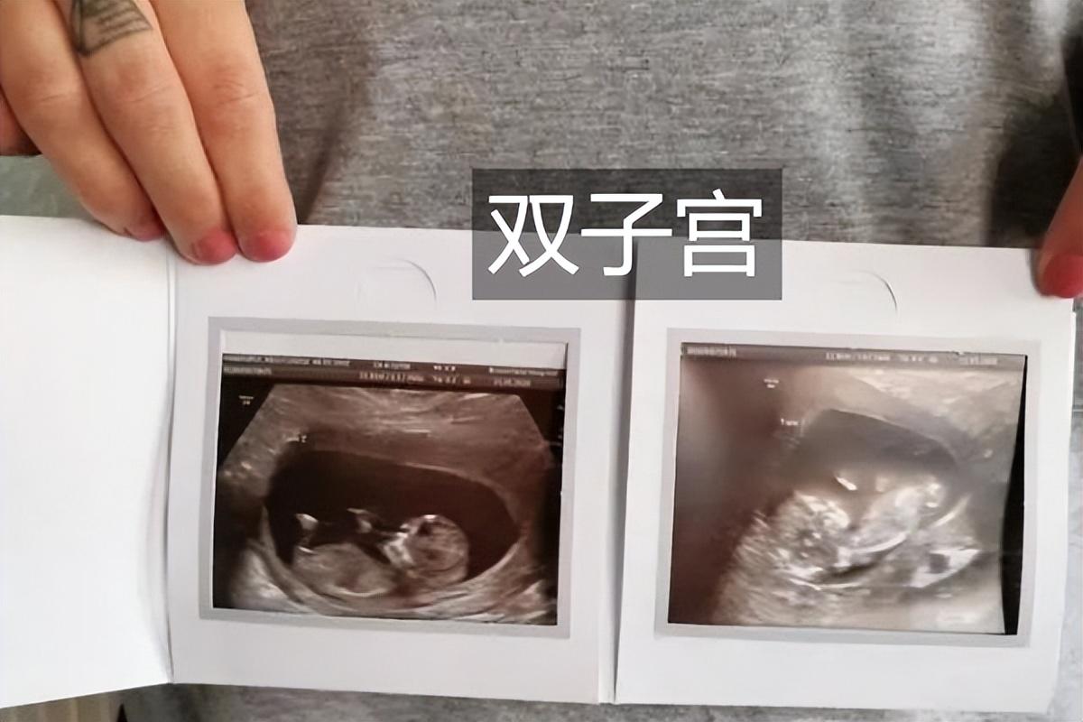 天降甘霖草木盛,牛肥羊壮家畜旺是什么生肖，详细解答、全面解答解释落实